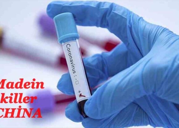 (Korona test kitlerimiz Çin’den)..Çin’den 2 milyon yeni test! İlk parti bugün geldi, kime nasıl uygulanacak?